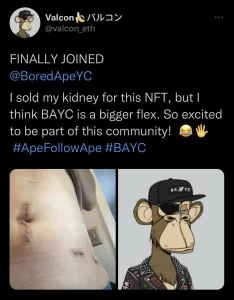 NFT kidney meme