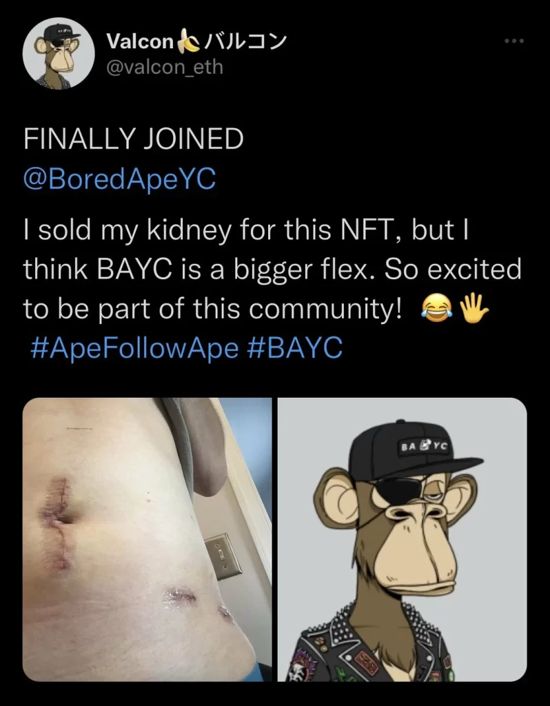 NFT kidney meme