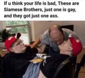 Siamese Brothers have it worse than you