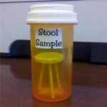 Stool Sample
