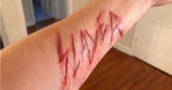 Slayer carved into skin