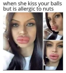 Baboon Ass Lips