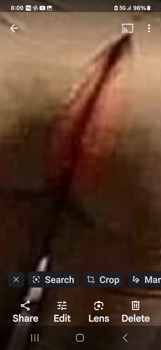 Infected butt crack