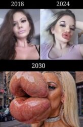 Fake Lips Then Now Forever