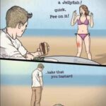Stung by a Jellyfish - Pee on it